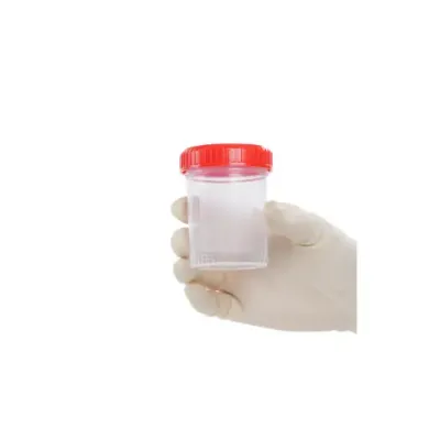 Picture of Specimen Containers